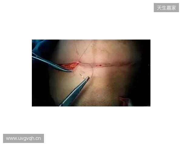 广州豹官方:杨浩眉弓伤口缝合30余针,预计5-7天后拆线